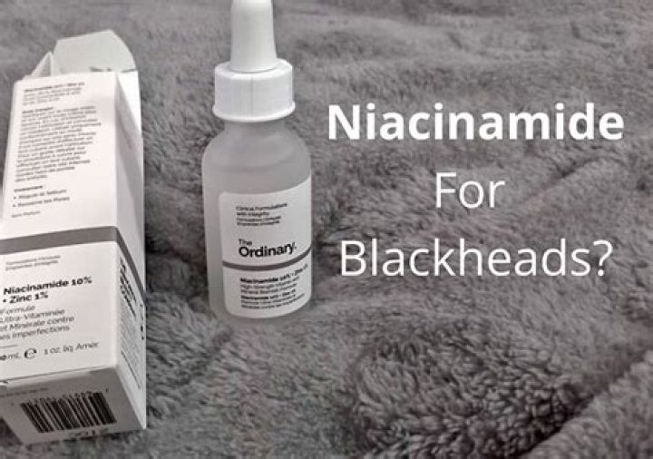 Does niacinamide help with blackheads?