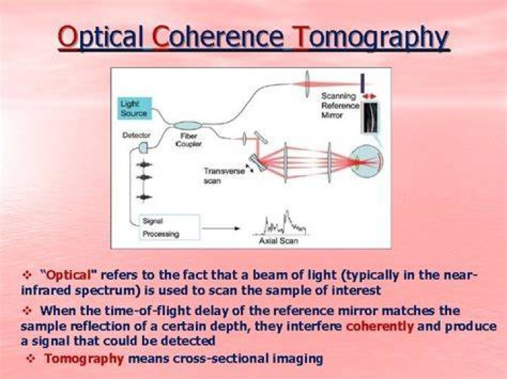 Does optical coherence tomography work?