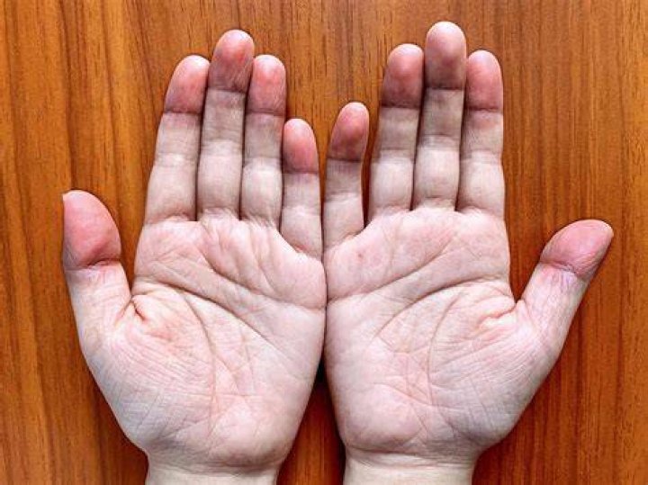 Does pale skin age faster?