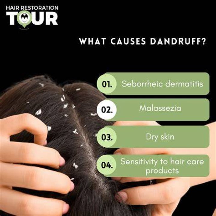 Does pomade cause dandruff?