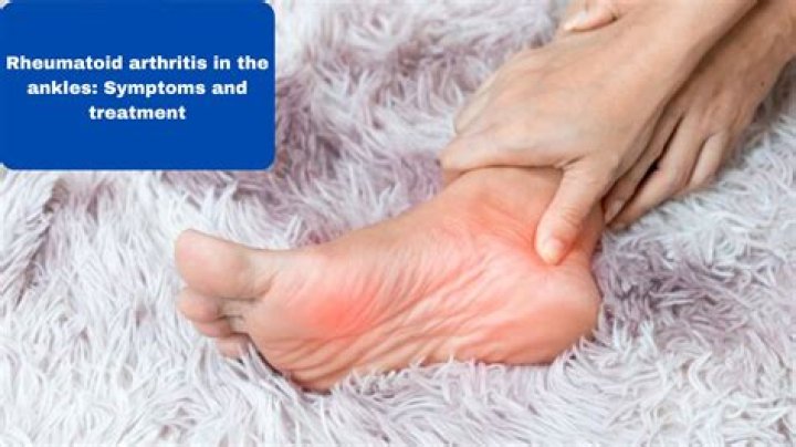 Does rheumatism go away?