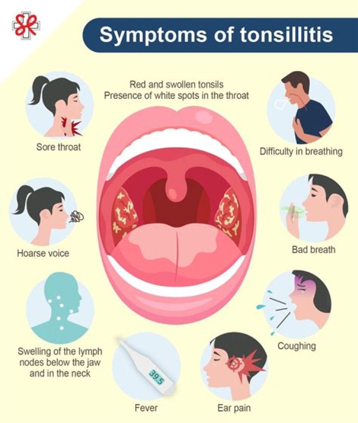Does tonsillitis go away by itself?
