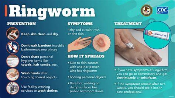 For how long is ringworm contagious?