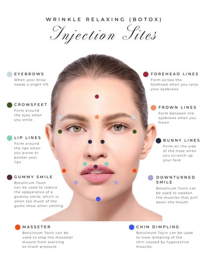 Has anyone ever died from botox injections?