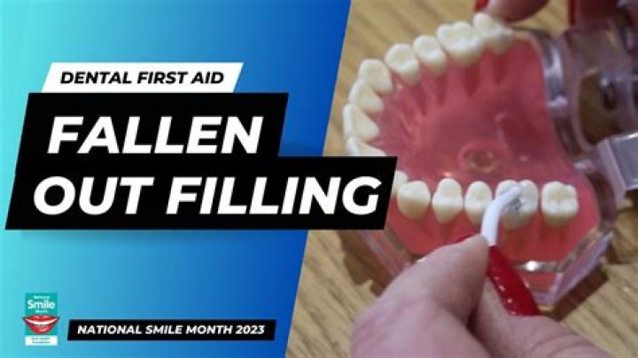 Has my filling cracked?