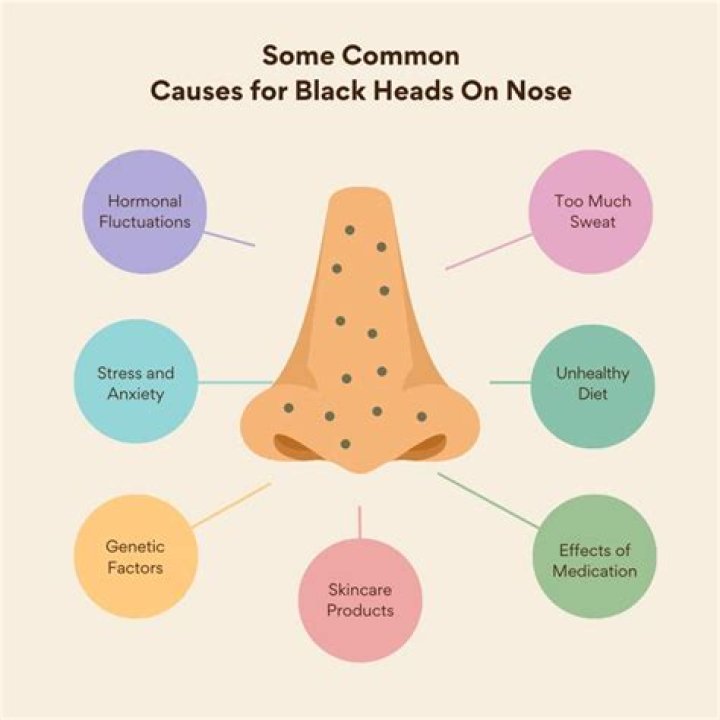 How blackheads are formed on nose?