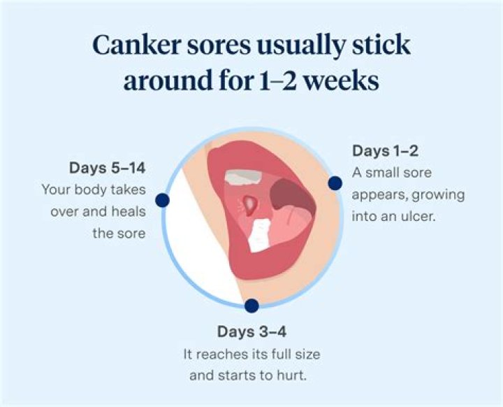 How do you get canker?