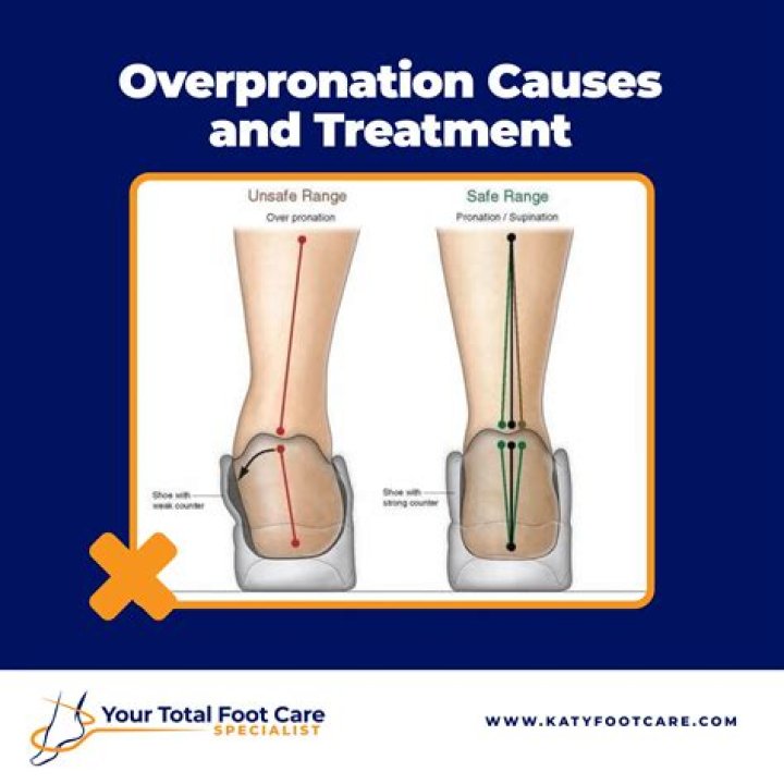 How does pes cavus happen?