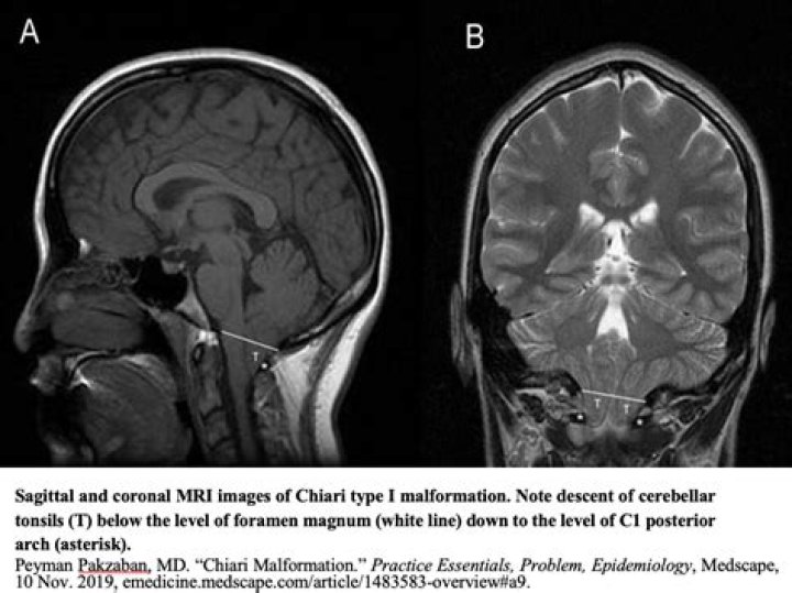 How is malformation diagnosed?