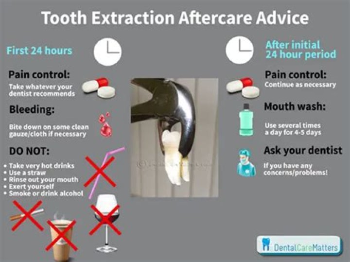 How long pain after tooth extraction?