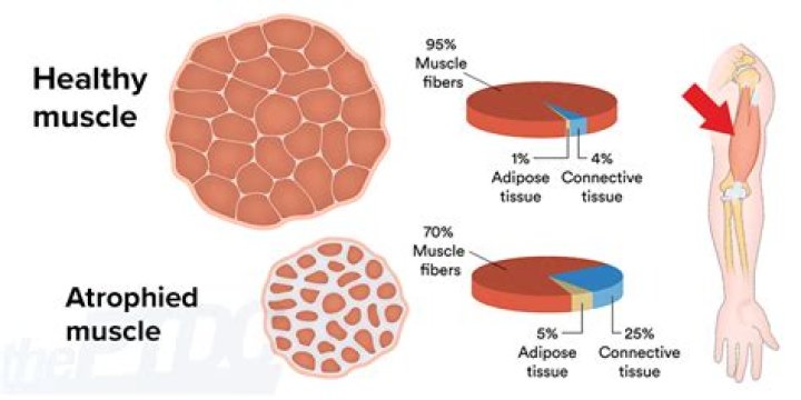 How long to rebuild atrophied muscle?