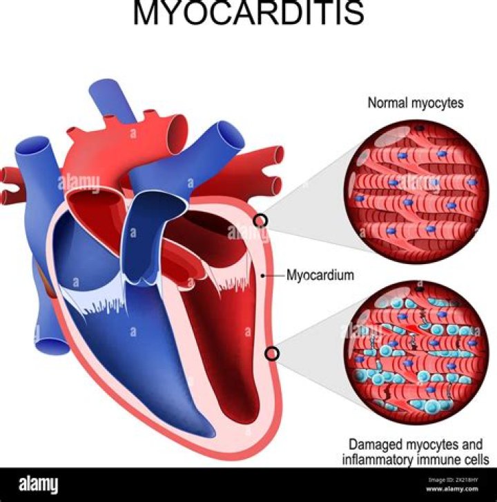 How many myocytes in the heart?