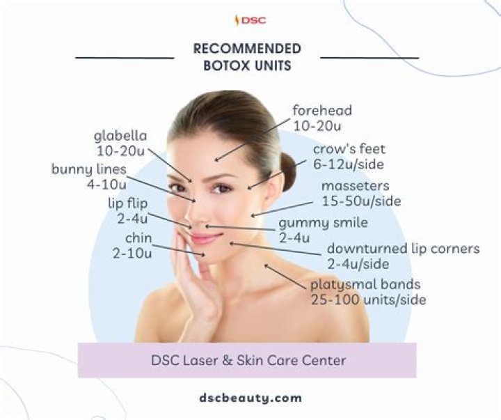 How much botox is needed for glabella?