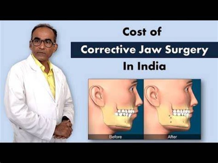 How much jaw surgery cost?