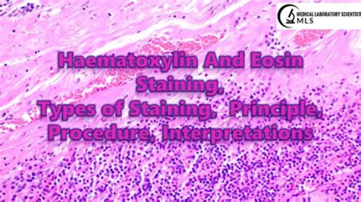 How to prepare hematoxylin and eosin staining?