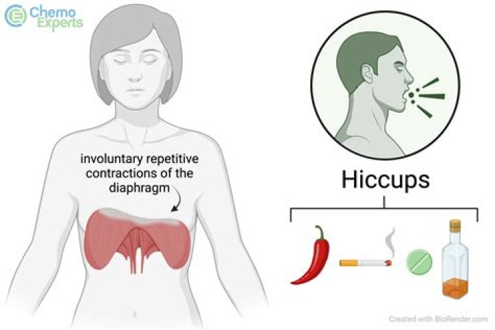 How to stop hiccuping fast?