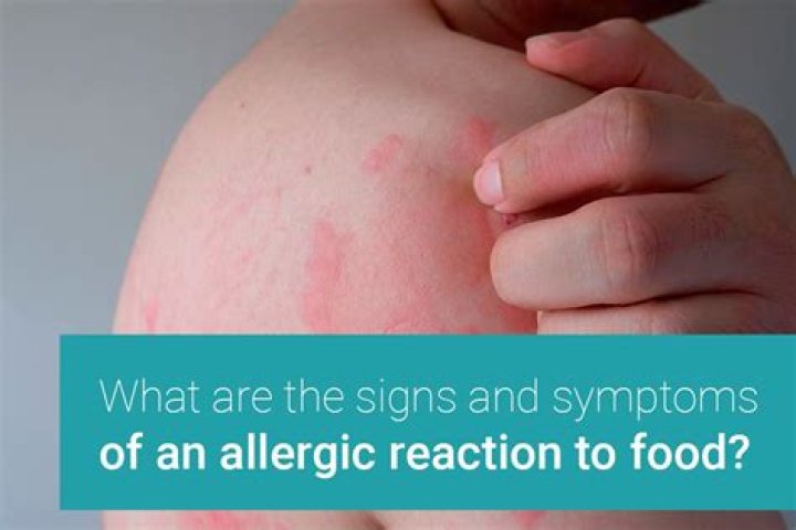 How to tell you're having an allergic reaction?