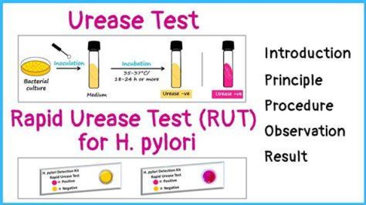 How urease test is done?