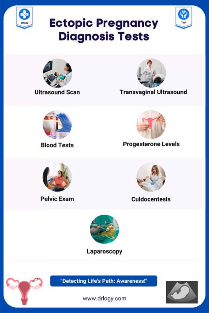 In ectopic pregnancy urine test is negative?