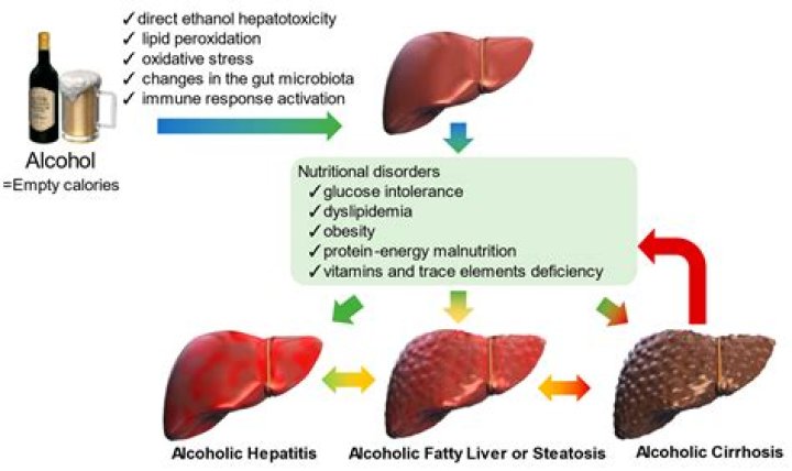 Is alcoholic fatty liver reversible?