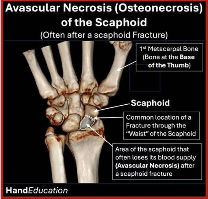Is bone avascular or vascular?