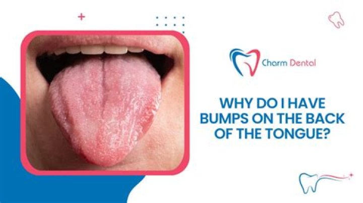 Is bumps on back of tongue covid?