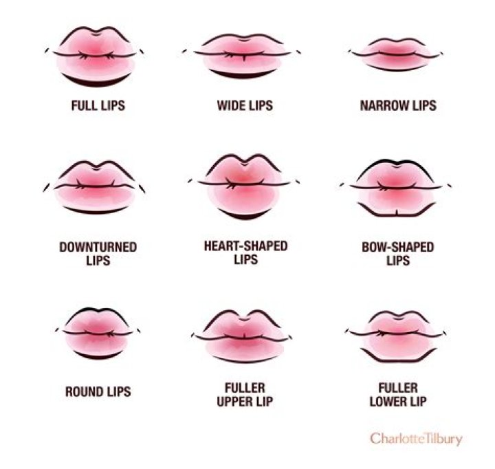 Is hare lip genetic?
