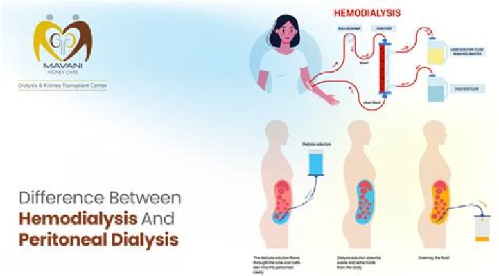 Is hemodialysis better than peritoneal?
