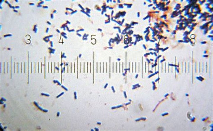 Is lactobacillus gasseri the same as acidophilus?