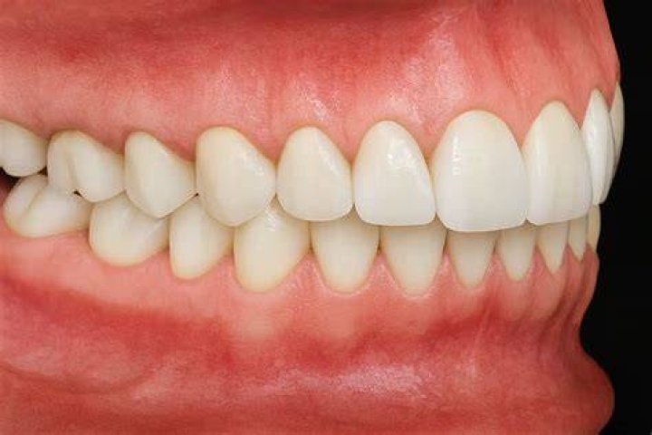 Is occlusion training bad for you?