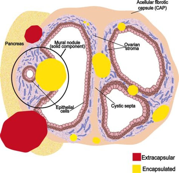 Is the acl extracapsular?