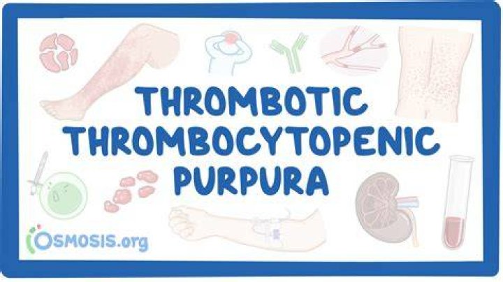 Is thrombotic thrombocytopenic purpura curable?