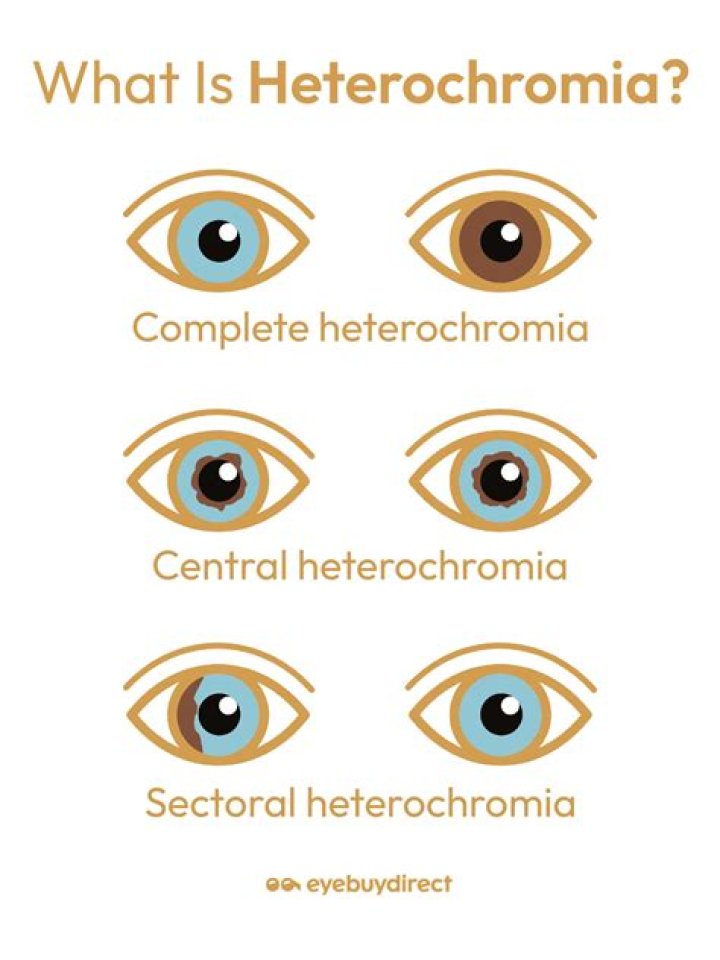 Is vertical heterophoria common?