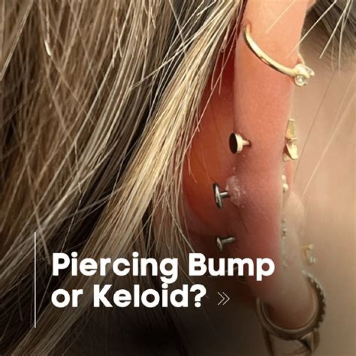 On a cartilage piercing?