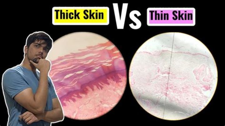 Should blood be thick or thin?