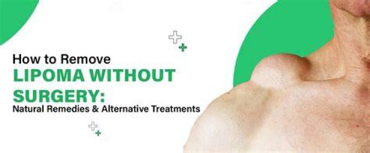 Should canine lipomas be removed?