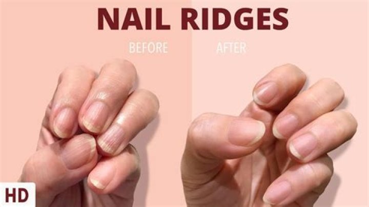 Should fingernails be white or pink?