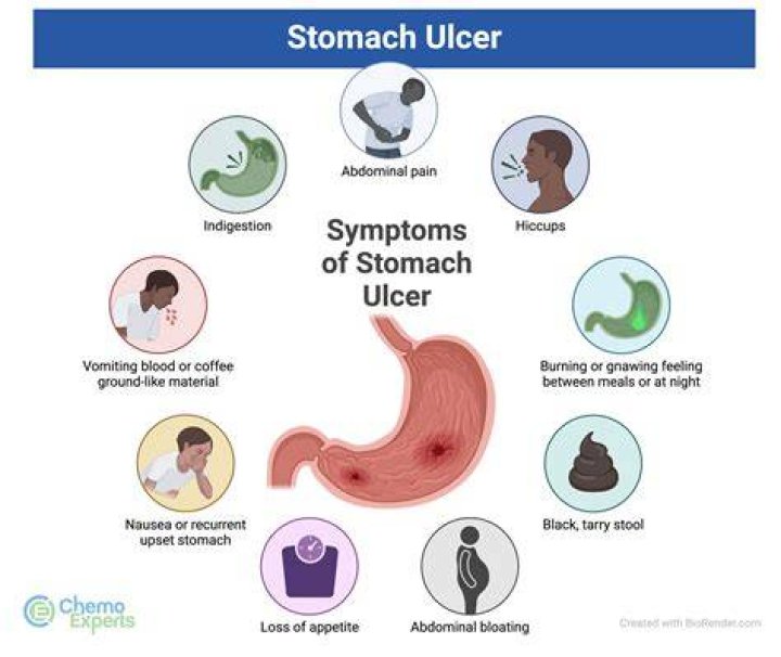 Should you go to er for ulcer?