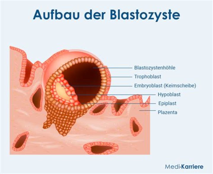 Was ist die blastocyste?