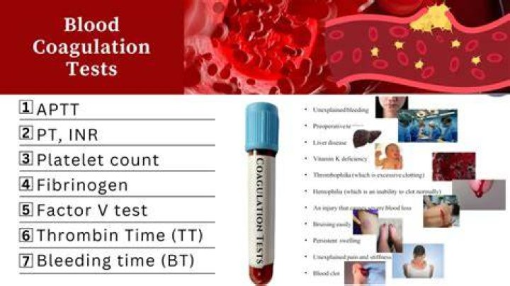 What anticoagulant is used for most coagulation tests?