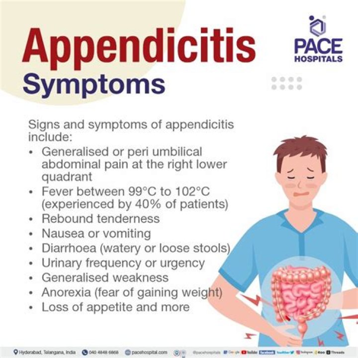 What are the signs and symptoms of appendicitis?