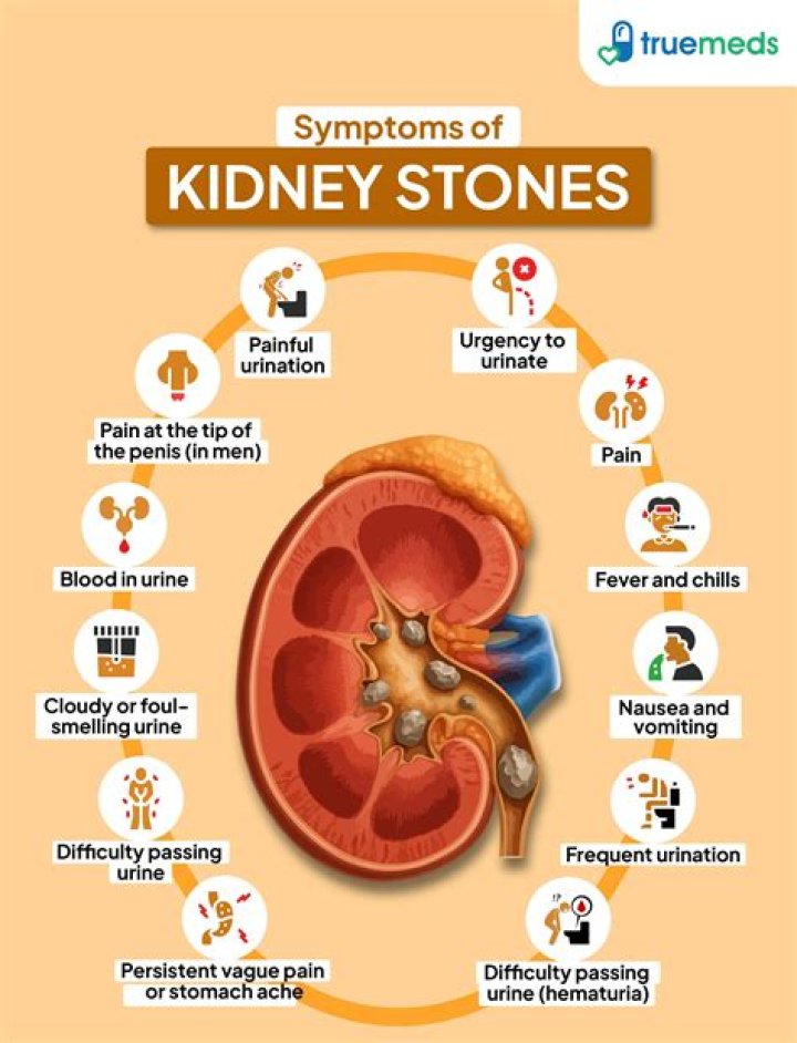 What are the symptoms of a kidney stones?