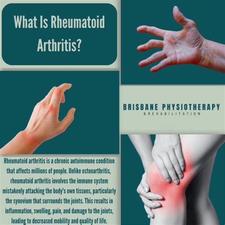 What causes deforming arthritis?