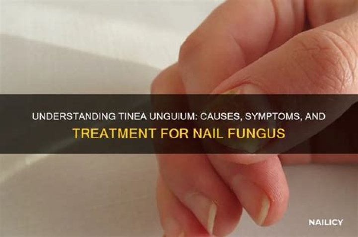 What causes tinea unguium?
