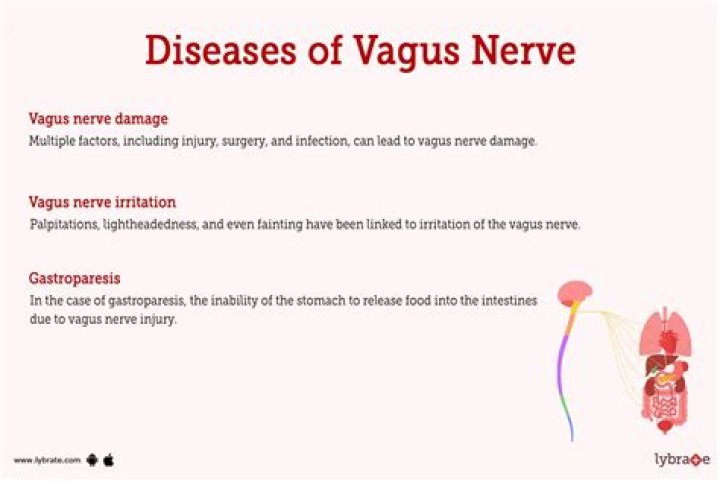 What causes vagus nerve damage?