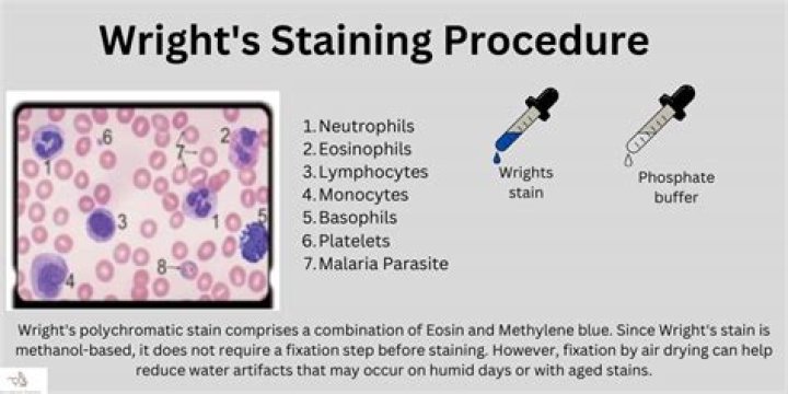 What do u mean by supravital stain?