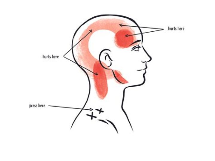 What does a long head mean?