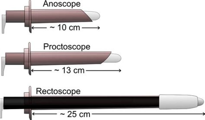 What does an anoscope do?