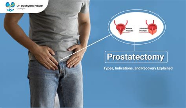 What does prostatectomy mean?