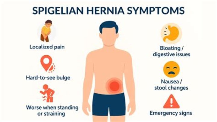 What does spigelian hernia feel like?